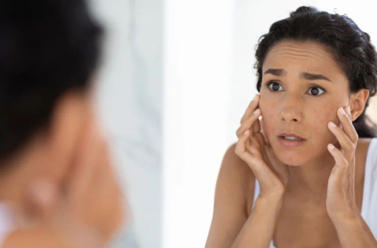 Selecting the right collagen biostimulators