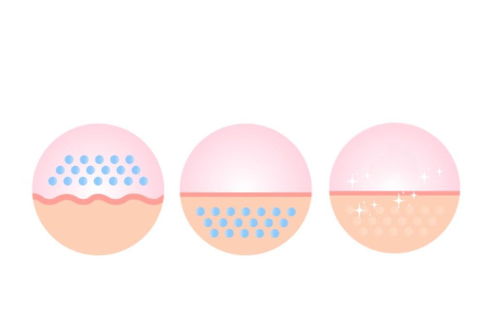 Plinest - Polyneucleotides (HPT)Plinest - Polynucleotides (HPT) for Anti Ageing